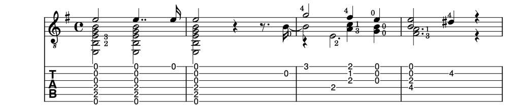 Mozart variations by Fernando sor guitar lesson introduction